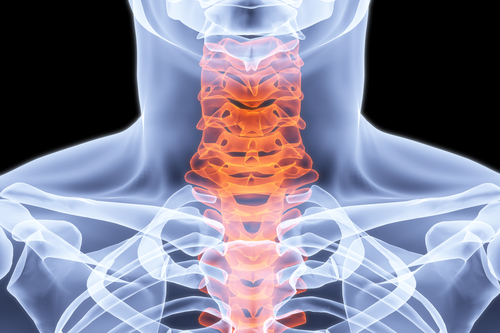 Neck pain Treatment for Neck Injury